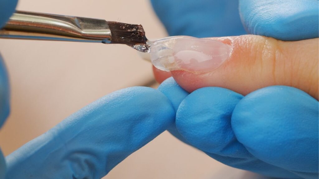 ¿Por qué quema el gel?