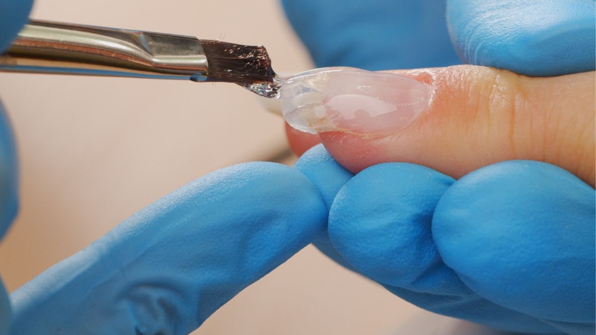 ¿Por qué quema el gel?